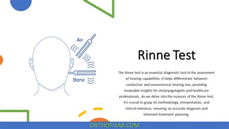 Rinne Test: What It Is and How It Works .